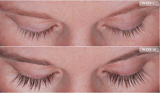 Los Angeles Eyelash Thinning Solution